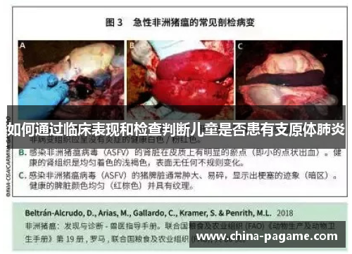 如何通过临床表现和检查判断儿童是否患有支原体肺炎